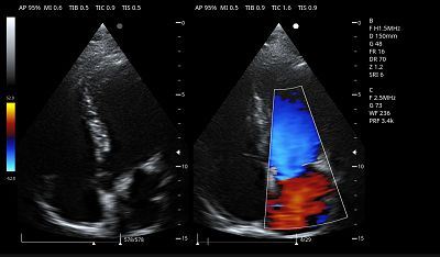 Cardiac B&C(001)
