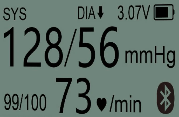 parameter