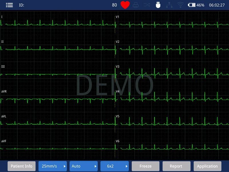 Smart 6 channel ECG machine(001)