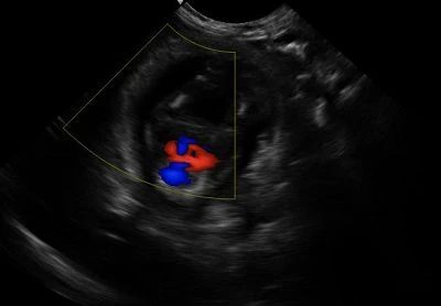 Canine-Fetal heart(001)