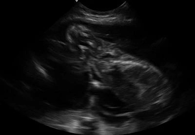 Canine-Fetal(001)