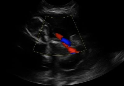 Canine-Fetal-5W-Cord(001)