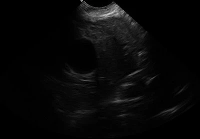 Canine-gallbladder(001)