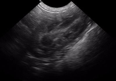 Canine-Left kidney(001)