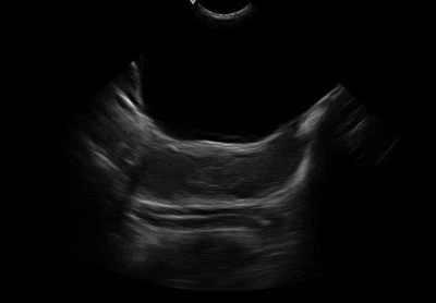 Canine-uterus body(001)